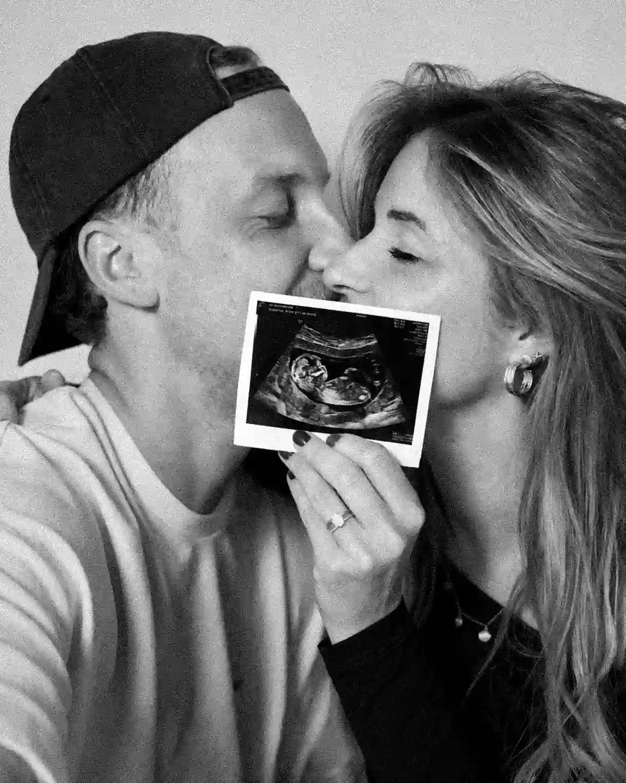 Black and white photo of a couple kissing with an ultrasound scan held low between their faces, he wears a backward cap