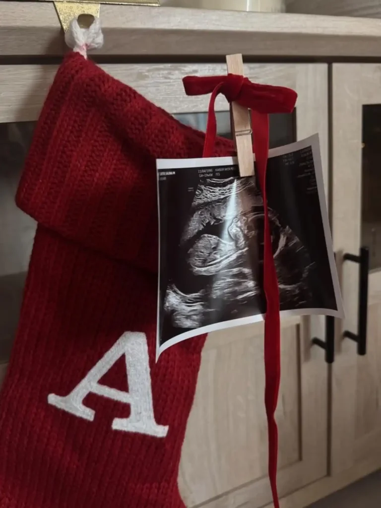 Red knit Christmas stocking with an ultrasound clipped to a velvet bow with a wooden clothespin
